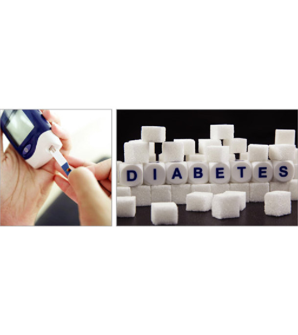 Buy Diabetic Screening (Male/ Female): Adults Online