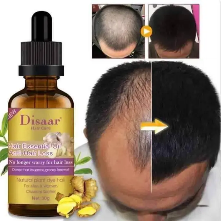 Buy Disaar 30ml Fast Hair Growth Essential Oil Ginger Formula Anti-hair Loss Oil Head Scalp Treatment For Men And Women at Best Price In Bangladesh