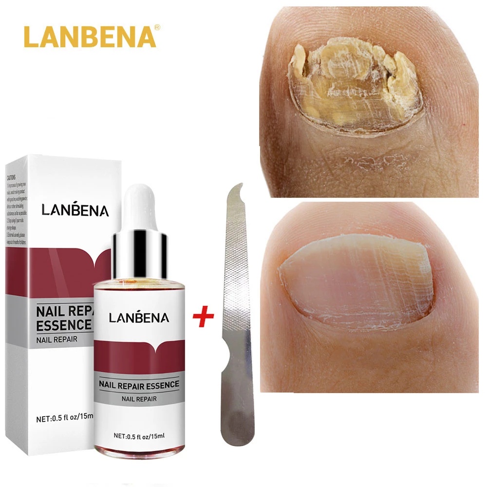 Picture of LANBENA Nail Repair Essence - 15ml