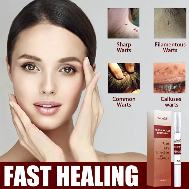 Buy "1pc Warts Remover Liquid Skin Tag Remover Skin Tag Herbal Treatment Wart Antibacterial Cream Remover Ointment Pen Liquid"  Online in Bangladesh