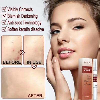 Buy 1pc Warts Remover Liquid Skin Tag Remover Skin Tag Herbal Treatment Wart Antibacterial Cream Remover Ointment Pen Liquid Online at Best Price In Bangladesh