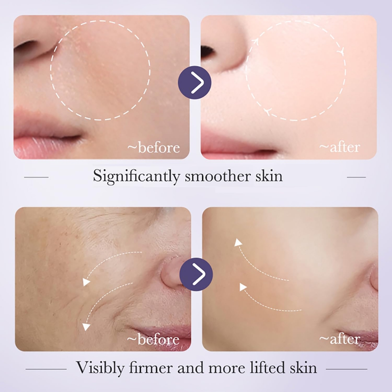 Buy BIOAQUA Facial Retinol Serum 30ml Anti-Wrinkle Tender Skin 8.5% Retinol 5% Hyaluronic Acid Moisturizing Essence at Best Price In Bangladesh