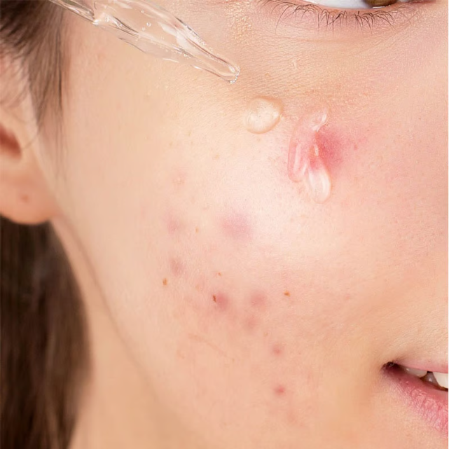 Picture of CARENEL Dr.Skin Niacinamide Zinc Serum 30ml