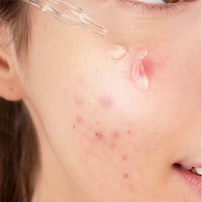 Picture of CARENEL Dr.Skin Niacinamide Zinc Serum 30ml