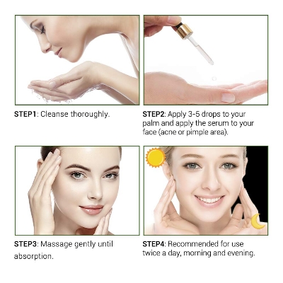 Picture of BREYLEE Acne Treatment Serum 17ml