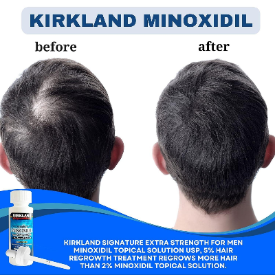 Picture of Kirkland Minoxidil 5% Topical Solution 60ml Extra Strength Hair Regrowth Treatment for Men Dropper Applicator Included
