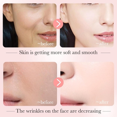 Picture of BIOAQUA Dispel Frekle Stable Soothing Nicotinamide Serum 30ml Niacinamide Face Moisturiser for Dry Skin