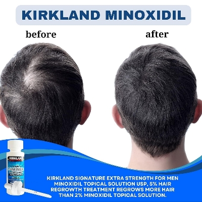 Picture of Kirkland Minoxidil 5% Topical Solution 60ml Extra Strength Hair Regrowth Treatment for Men Dropper Applicator Included
