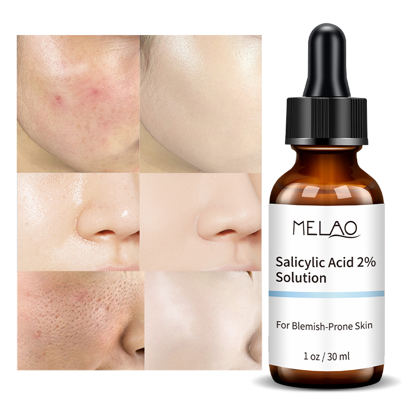 Picture of Melao Salicylic Acid 2% Solution 30ml | Korea