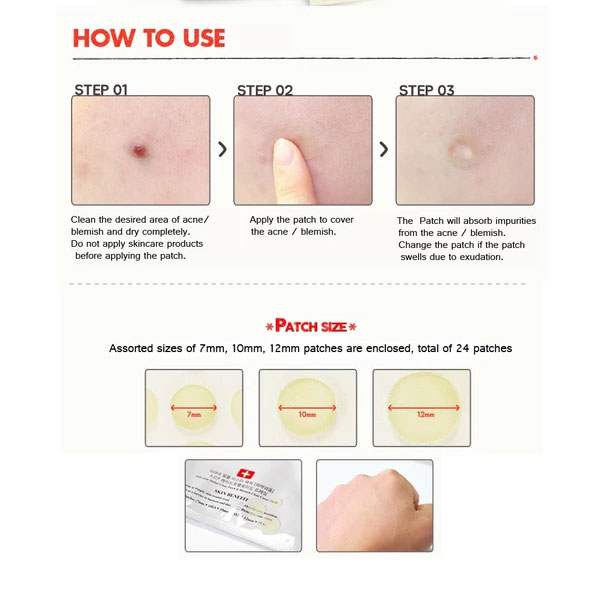 Picture of Cosrx Acne Pimple Master Patch 24 Patch | Korea