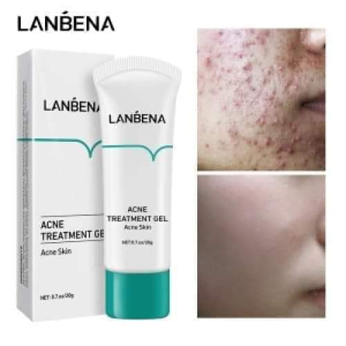 Picture of Lanbena Acne Treatment Gel