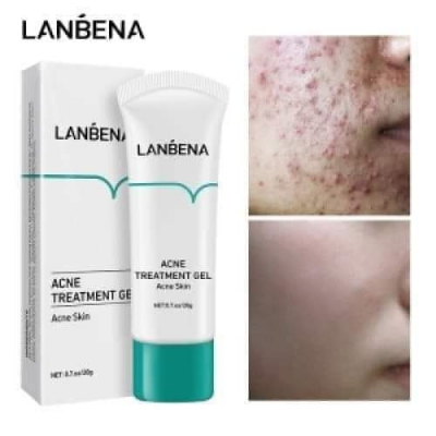 Picture of Lanbena Acne Treatment Gel