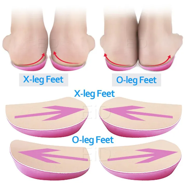 Buy xo-legs-orthopedic-shoes-insoles-silicone-gel-arch-support-pad-for-women-flat-foot-orthotic-inserts-pain-relief-high-heel-pads Best price in Bangladesh