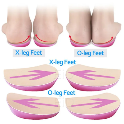 Buy xo-legs-orthopedic-shoes-insoles-silicone-gel-arch-support-pad-for-women-flat-foot-orthotic-inserts-pain-relief-high-heel-pads Best price in Bangladesh