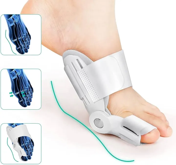 Buy oe straightener bunion corrector for women splint with toe fracture support and foot support for pain relief toe separator for both(1 pcs)   Best price in Bangladesh