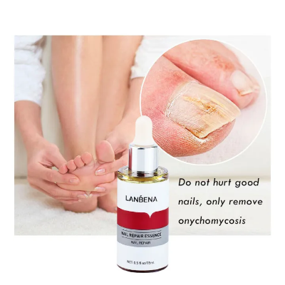 Picture of LANBENA Nail Repair Essence Serum Fungus Treatment Nail Removal Onychomycosis-15ml