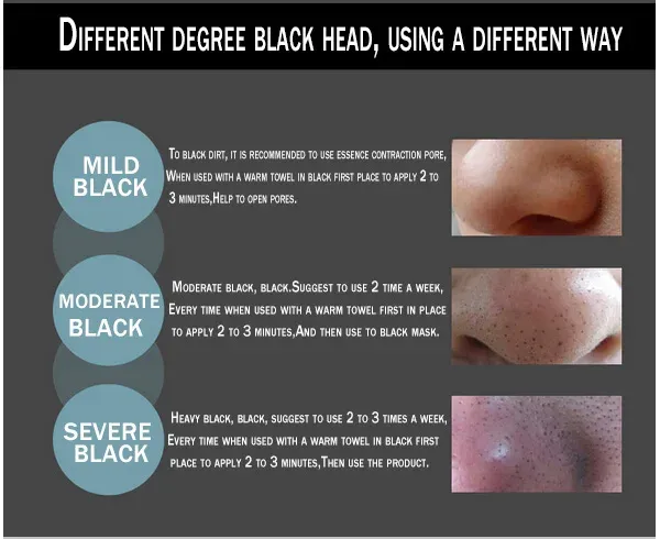 Picture of Blackhead Deep cleansing Purifying Peel Acne Pimples Remover Black Mud Mask skin care product- 60g face mask