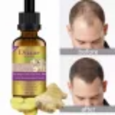 Picture of DISAAR Hair Growth Essential Oil Natural Plant Dry Growth Essence Anti Hair Loss Scalp Treatments Genseng Raise Dense 30g |