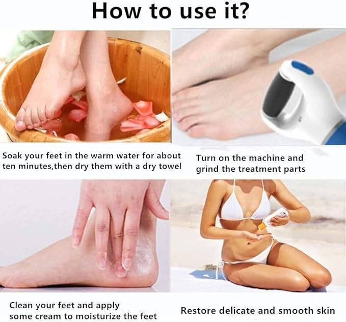 Picture of Surat Dream Dead Skin Remover Foot Scrubber For Cracked Heels Feet Callus Remover Electric Pedi Roller Leg