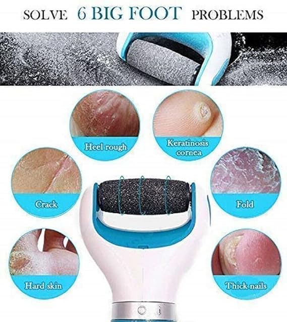 Picture of Surat Dream Dead Skin Remover Foot Scrubber For Cracked Heels Feet Callus Remover Electric Pedi Roller Leg