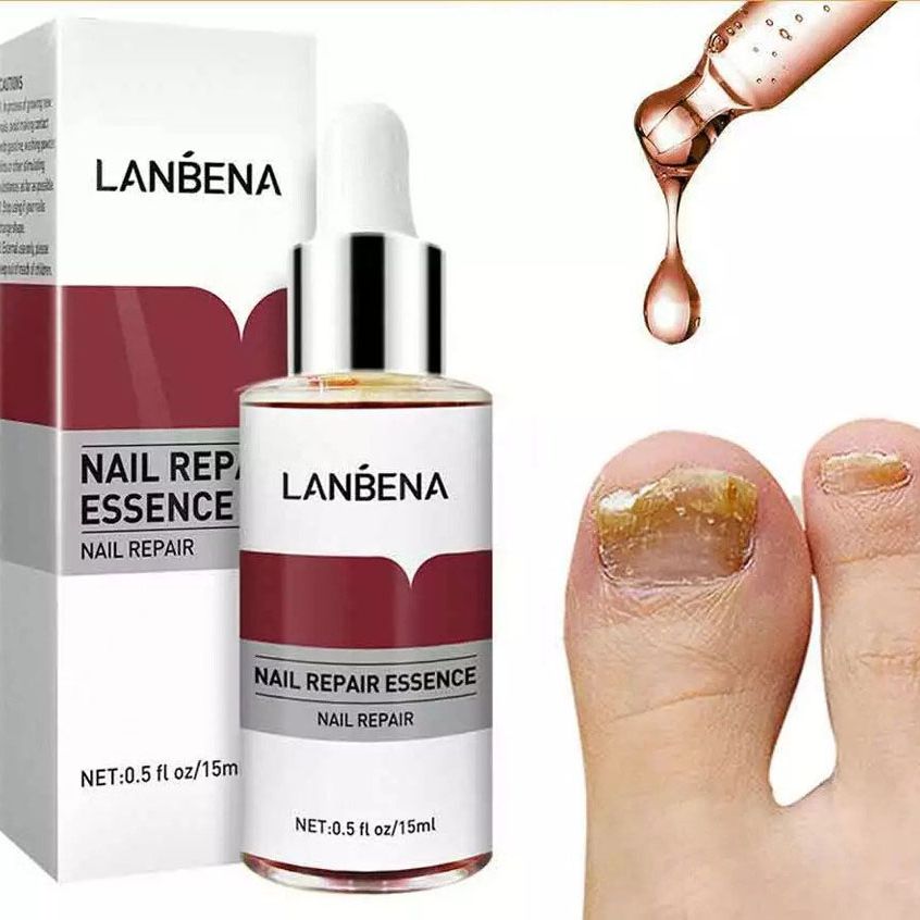 Picture of LANBENA Nail Repair Essence Serum Fungal Nail Treatment Remove Onychomycosis Toe Nourishing Brighten Hand Foot Skin Care