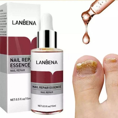 Picture of LANBENA Nail Repair Essence Serum Fungal Nail Treatment Remove Onychomycosis Toe Nourishing Brighten Hand Foot Skin Care