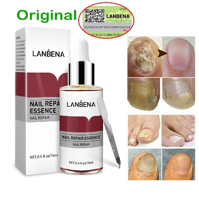 Picture of LANBENA Nail Repair Essence Serum Fungal Nail Treatment Remove Onychomycosis Toe Nourishing Brighten Hand Foot Skin Care