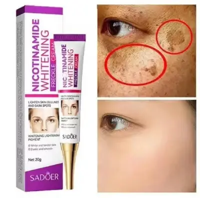 Picture of Sadoer Nicotinamide Whitening Freckle Cream 20g Lighten Dark Spots