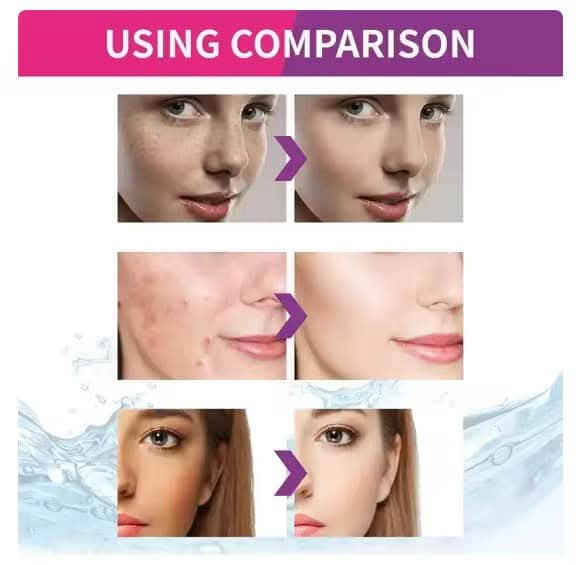 Picture of Sadoer Nicotinamide Whitening Freckle Cream 20g Lighten Dark Spots