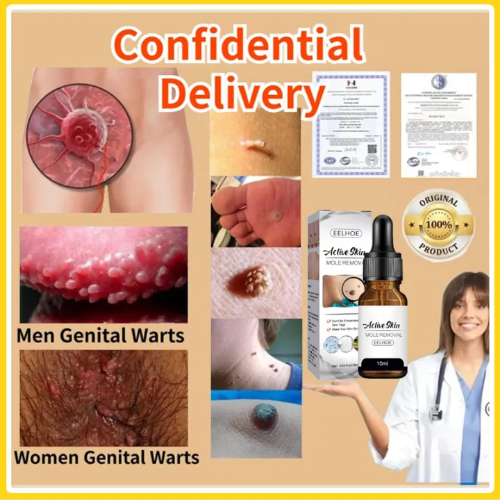 Picture of EELHOE Aclive Skin Mole Removal Essence Skin Tag Remover Mole Genital Wart Removal Antibacterial Liquid Painless Mole Skin Dark Spot Remover Serum Face Wart Tag Removal Solution 10ml