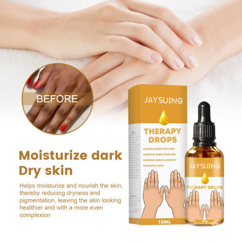 Picture of JAYSUING Therapy Drops-Reduce Dark Spot & Lightens Skin Discoloration 10ML