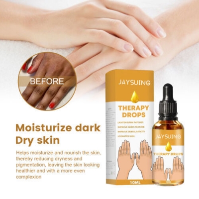 Picture of JAYSUING Therapy Drops-Reduce Dark Spot & Lightens Skin Discoloration 10ML