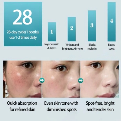 Picture of Japanese Melasma Cream, Hoshi Cream Japan, Dr Hancy White Spot Freckle Face Cream, Anti Ageing Face Moisturizing Skin Care Cream for All Type Skin (1PCS)