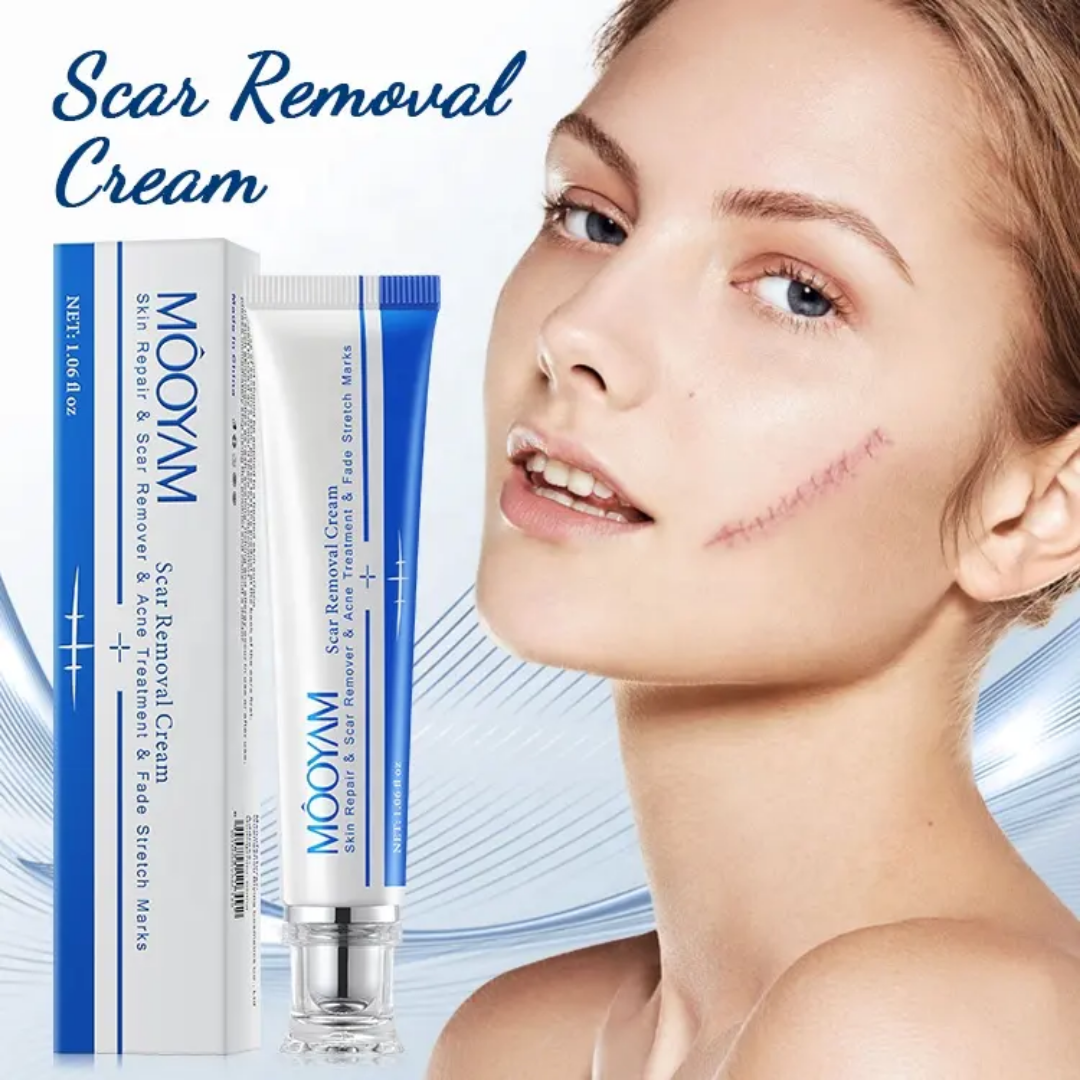 Picture of MOOYAM Scar Removal Cream