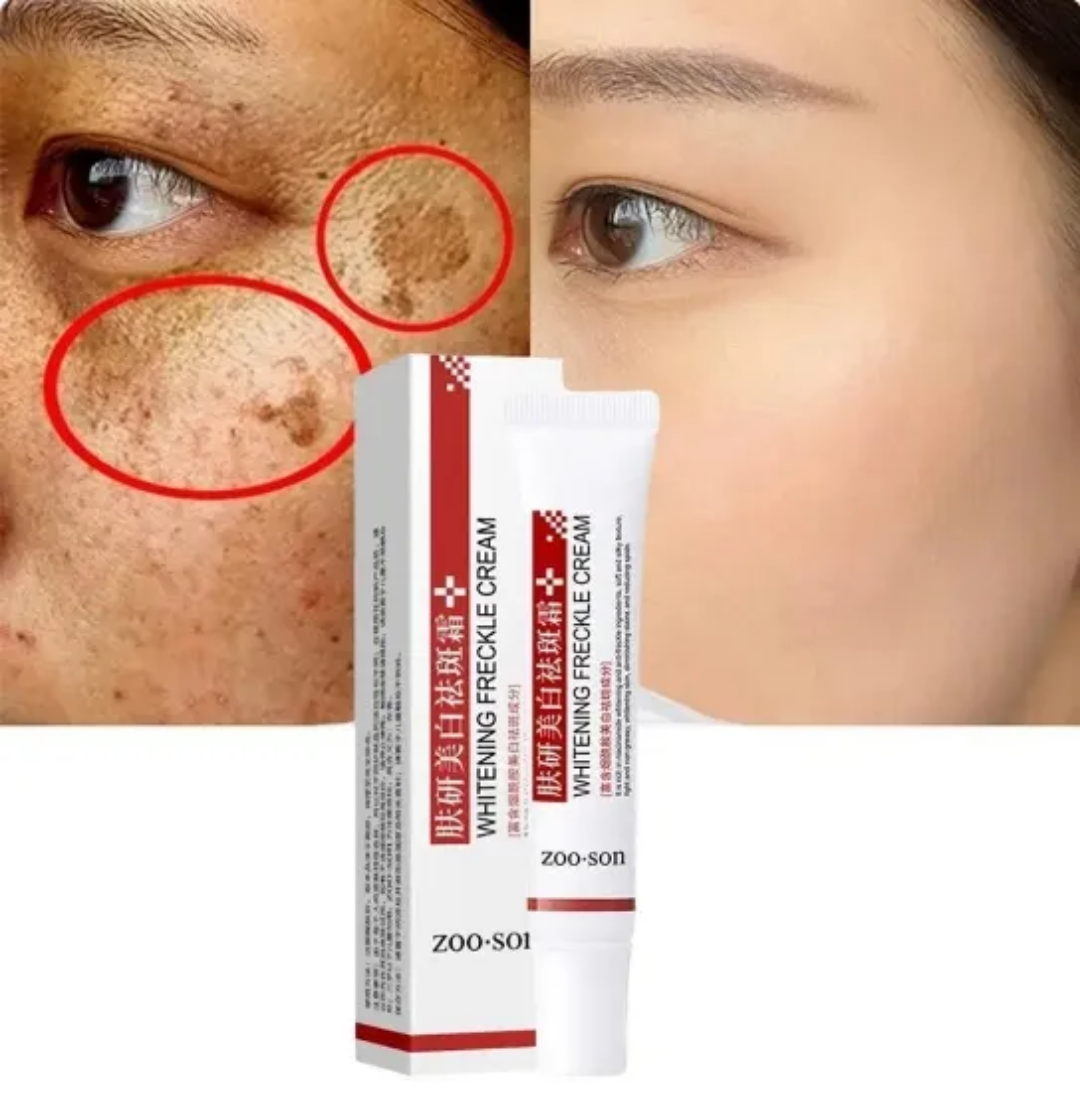 Picture of Zoo Son Whitening Freckle Cream