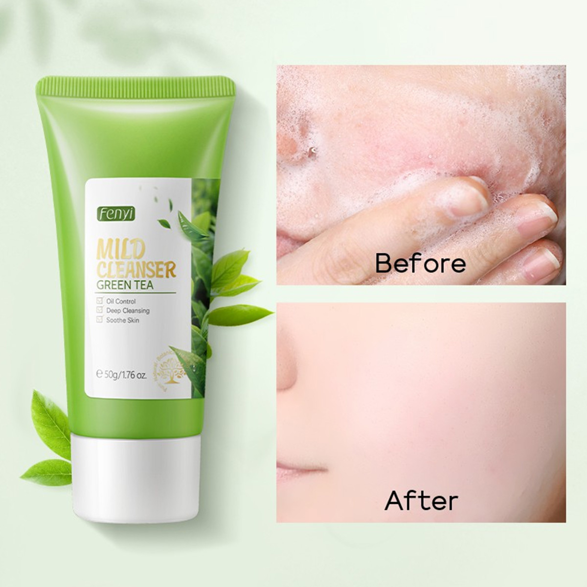 Picture of Fenyi Green Tea Cleanser/Toner/Lotion/Eye cream/Serum/Cream (Combo)