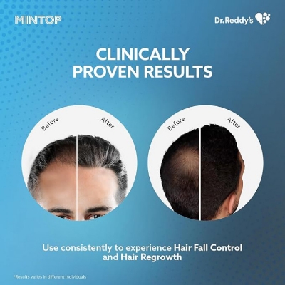 Picture of Mintop Forte 5% Hair Restore Formula with Minoxidil Reduces Hairfall 60ml INDIAN