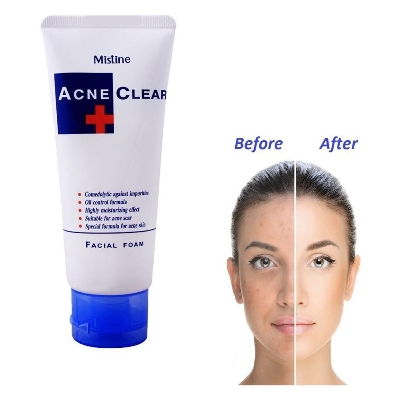 Picture of Mistine Acne Clear Facial Foam 85g THAILAND