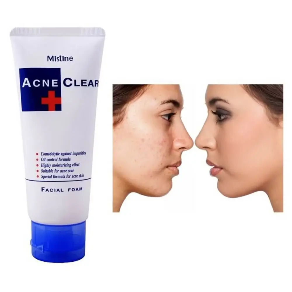 Picture of Mistine Acne Clear Facial Foam 85g THAILAND