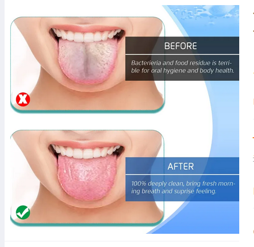 Picture of Tongue Scraper, Tongue Cleaners, fresher Tongue Tools 1 pcs