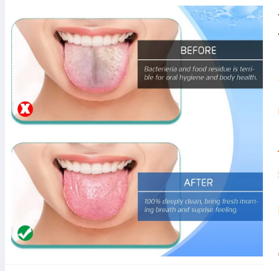 Picture of Tongue Scraper, Tongue Cleaners, fresher Tongue Tools 1 pcs