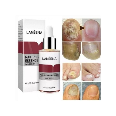 Buy Lanbena Nail Repair Essence And Anti-fungal Solution (15ml)  at Best Price In Bangladesh