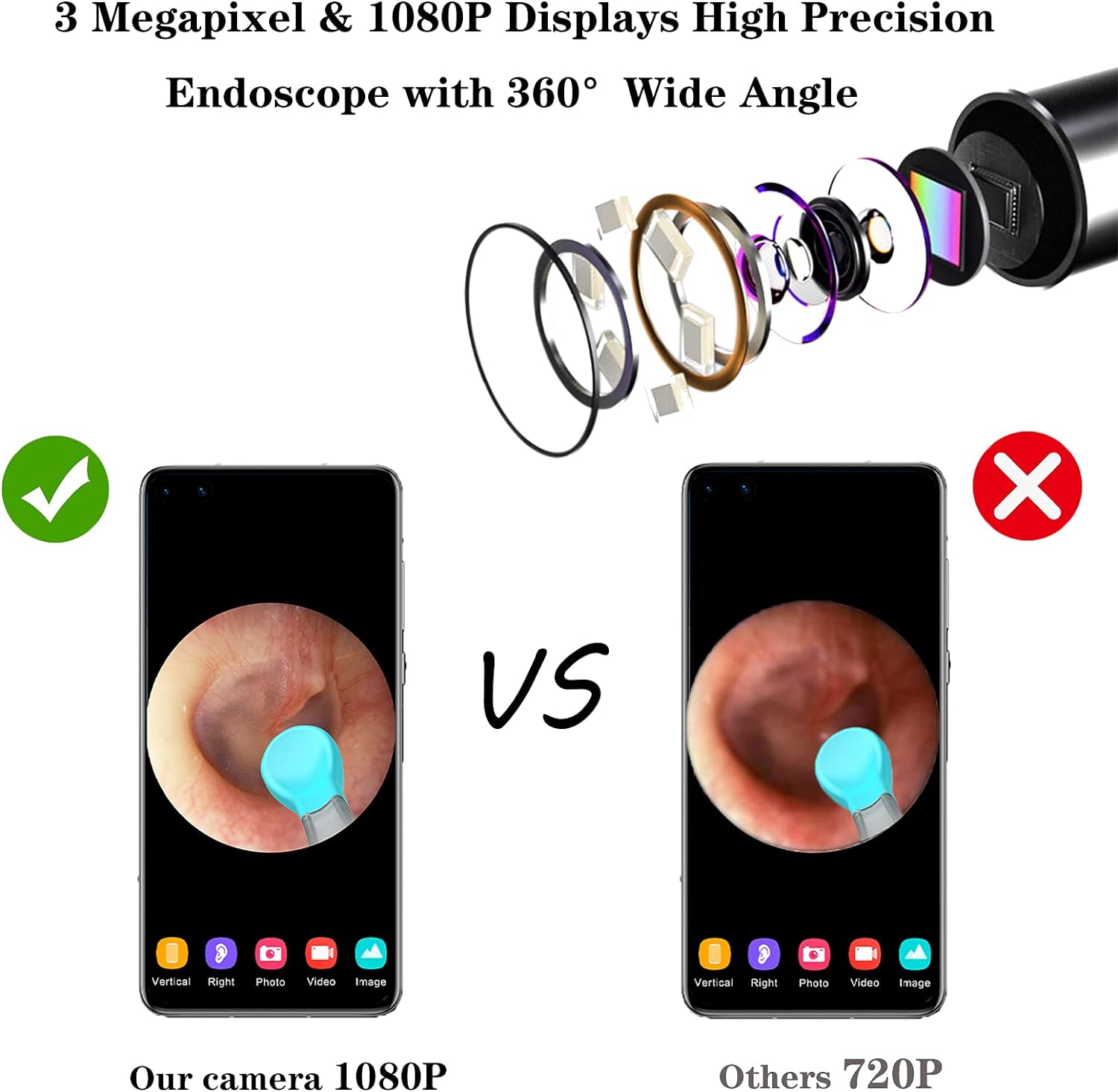 Picture of Xiaomi Bebird R1 Wireless Intelligent Visual Ear Stick Precision Endoscope