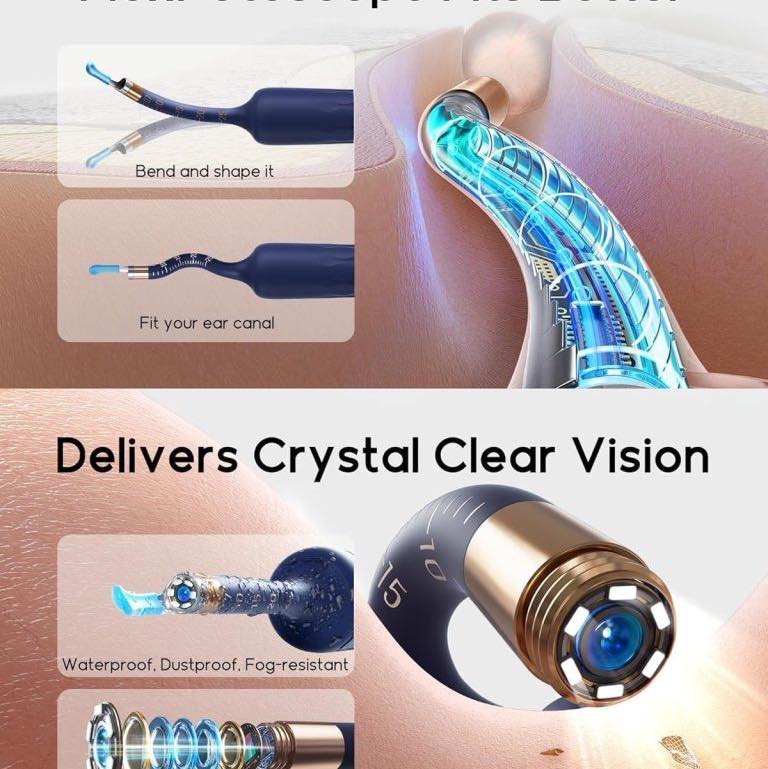 Picture of Bebird EarSight Plus Smart Visual Ear Cleaner Camera