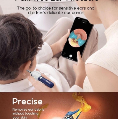 Picture of Bebird EarSight Plus Smart Visual Ear Cleaner Camera