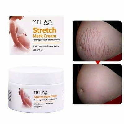 Picture of Stretch Mark Cream Scar Removal 120g