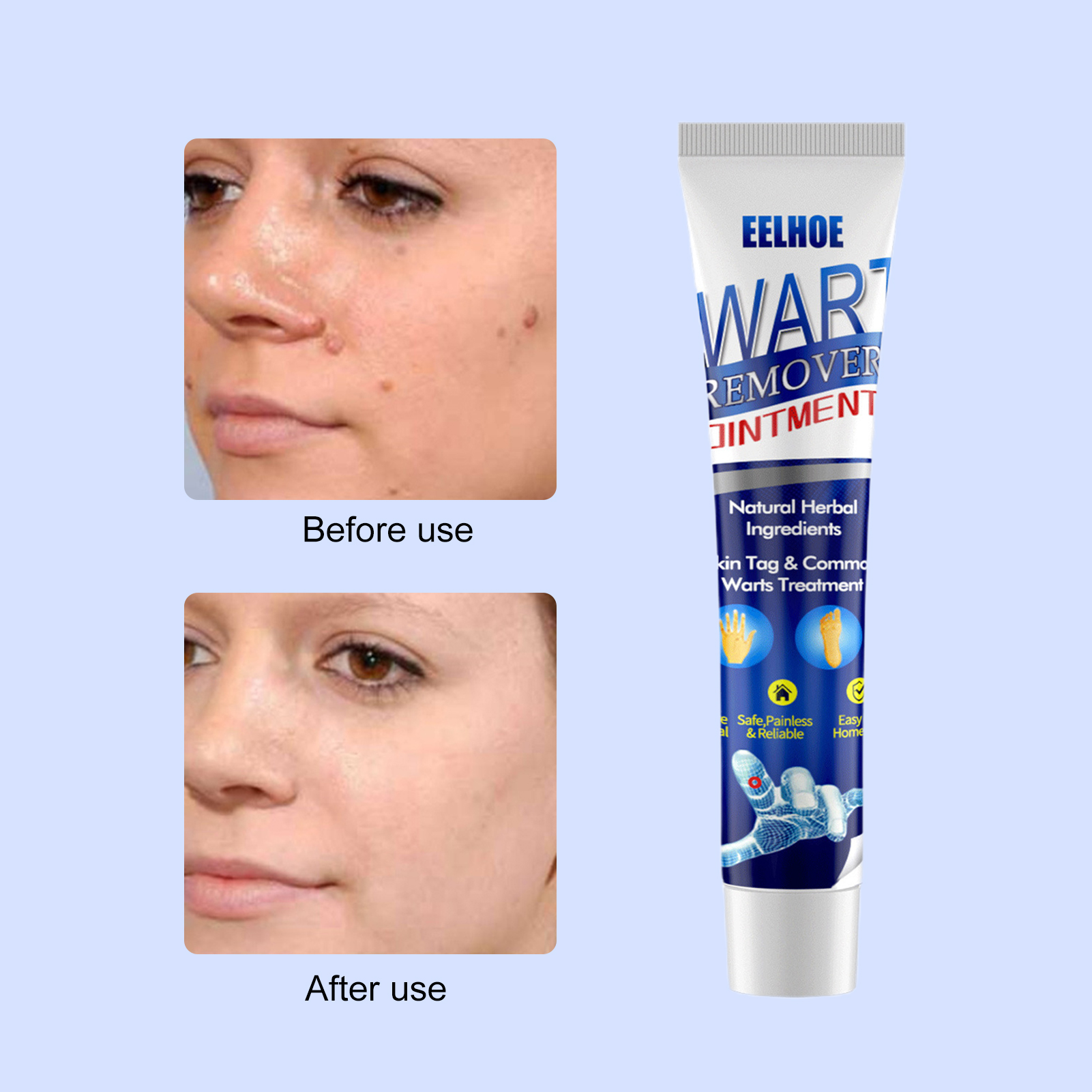 Picture of Warts & Skin Tag Remover Ointment: Treatment Cream