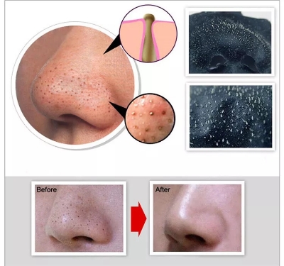 Picture of Bioaqua Activated Carbon Mask Mini Blackhead Remover Mask-1PCS