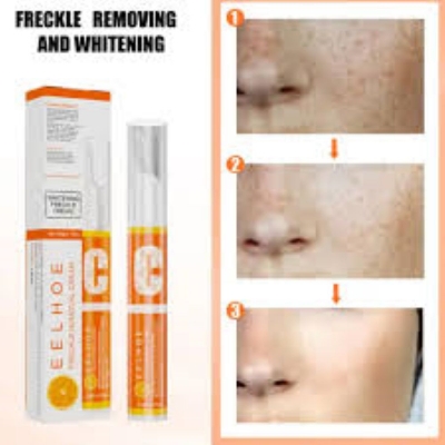 Picture of EELHOE vitamin c freckle removal whitening cream chloasma spots removing sunburn repairing hydrating whitening and freckle cream