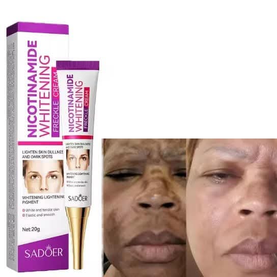 Picture of Sadoer Nicotinamide Whitening Freckle Cream 20g Lighten Dark Spots